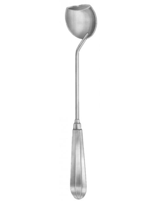 Moore Gall Stone Scoops 28cm/11